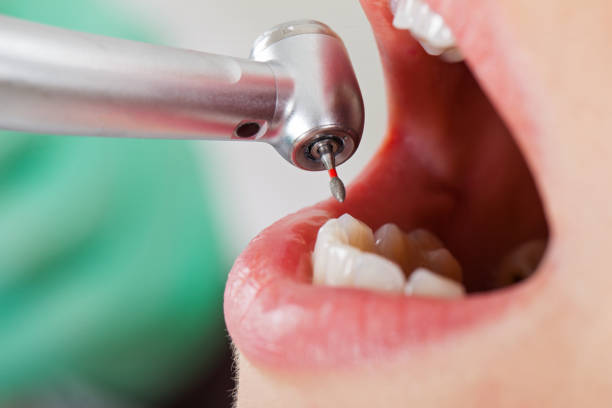 Best Broken or Cracked Tooth Emergency Dentist in Roland, IA
